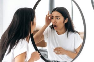 Cara Mengatasi Wajah Perih Saat Memakai Skincare